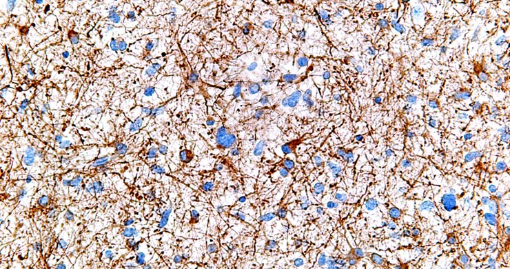 What is the role of DNA methylation in neural development, function, and disorders?